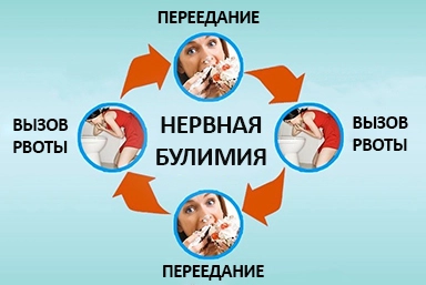 Лечение булимии в Волгореченске